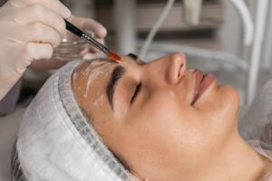 Is Inno Peel the Best Chemical Peel Option?