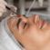 Is Inno Peel the Best Chemical Peel Option?