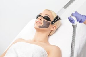 Is Laser Carbon Peel Safe for All Skin Types?