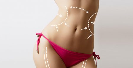Lipomatic Treatment Fast and Safe Fat Removal