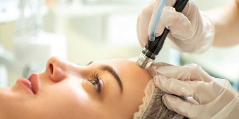 Mole Removal for Face and Bod