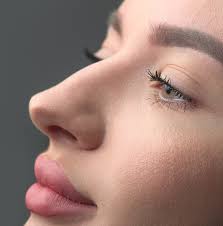 Nose contouring surgery