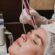Pico Laser for Tattoo Removal and Pigmentation