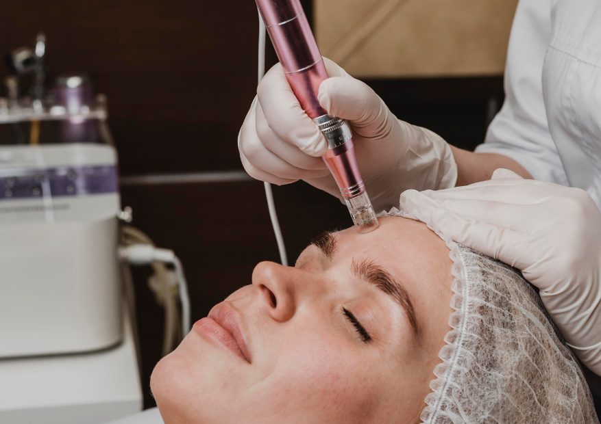 Pico Laser for Tattoo Removal and Pigmentation