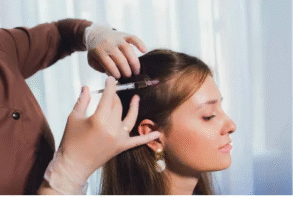 Hair transplant cost in Dubai