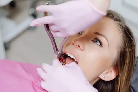 Private Dental Charges Tooth Extraction