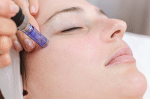Quick and Effective Mesotherapy Sessions
