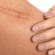 Regain Your Natural Appearance with Burn Reconstructive Surgery