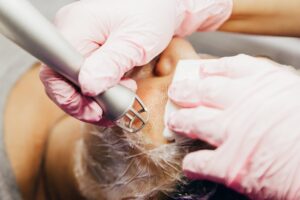 Reveal Clear and Radiant Skin with Fractional CO2 Laser