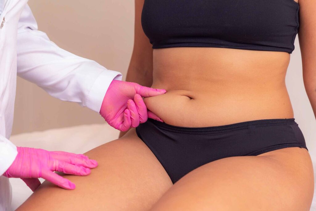 Fat Melting Injection in Dubai