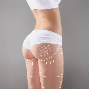 What Makes Buttock Augmentation So Popular Today
