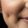 What Makes Dimple Creation So Popular Today