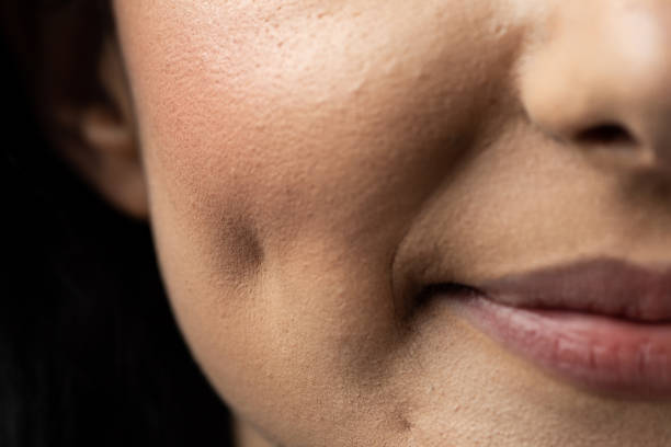 What Makes Dimple Creation So Popular Today