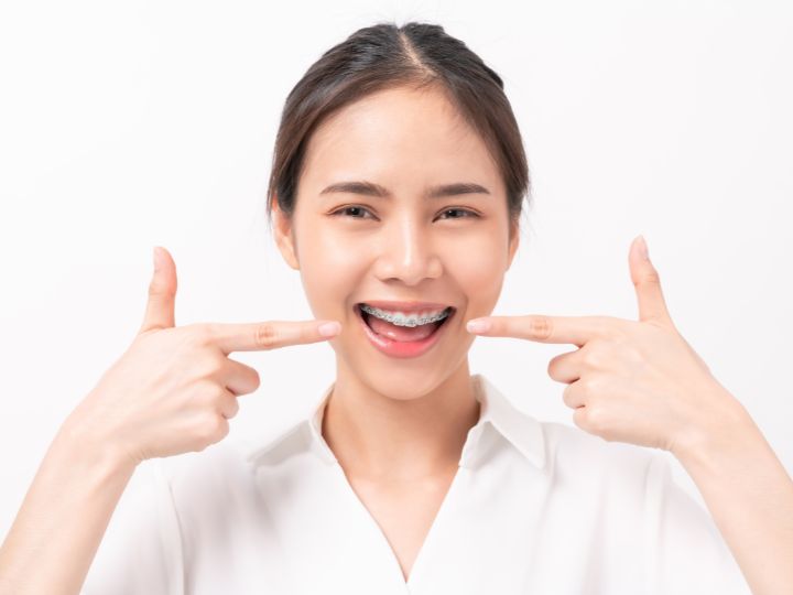 how much are braces