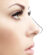 Rhinoplasty