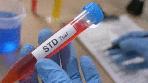 STD Test in Dubai