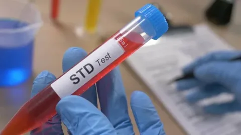 STD Test in Dubai: