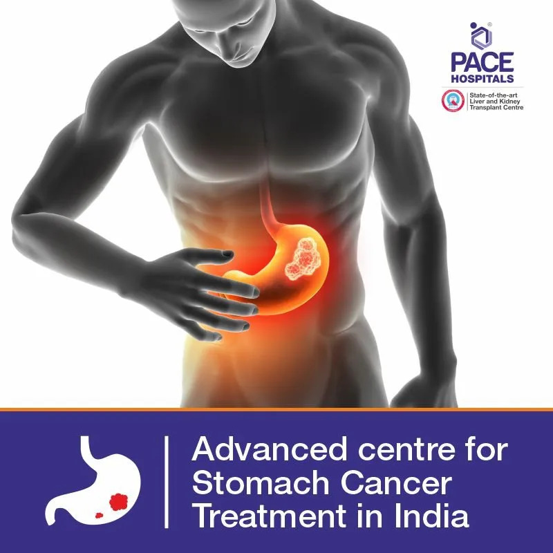 Stomach cancer doctors in Hyderabad