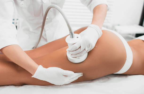 Cellulite Treatments to Boost Your Confidence