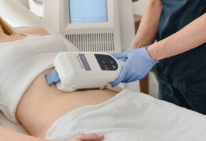 CoolSculpting