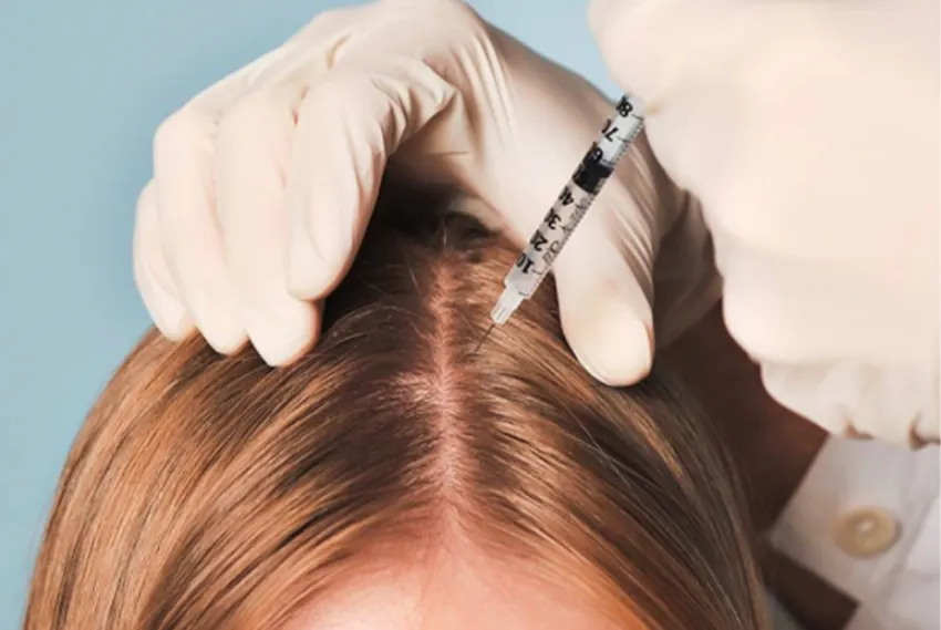 Is Hair Filler Treatment Effective for Hair Loss?