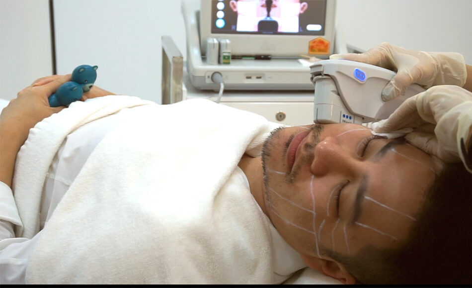 What Are the Real Results of Ultherapy on Aging Skin?