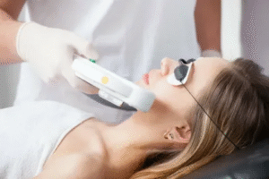 Laser Treatment in Dubai