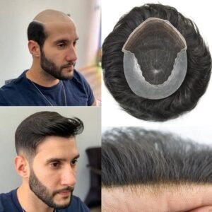 hair replacement system