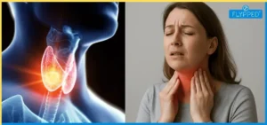 Thyroid-Kya-Hota-Hai