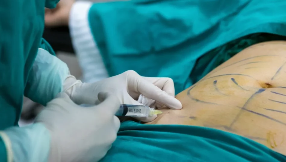 Liposuction in Islamabad