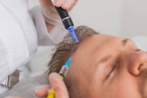 exosome hair in Dubai