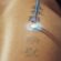 Picosure Tattoo Removal In Islamabad