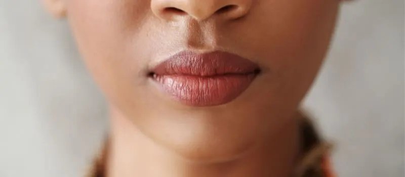 Smoker Lips Treatment in Islamabad
