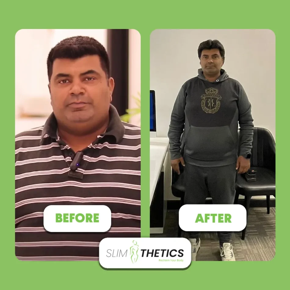 bariatric-surgery-khalid-before-after-copy