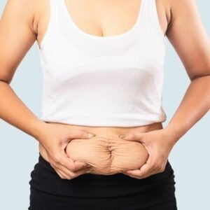 post weight loss