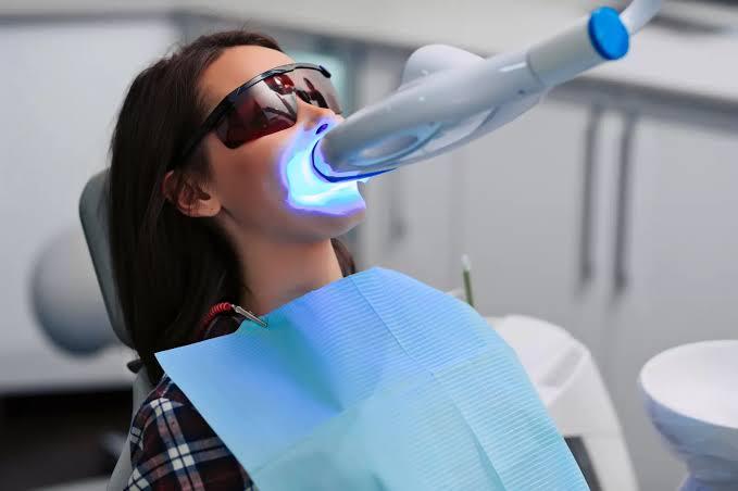 teeth whitenig in Islamabad