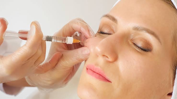 Cheek Fillers Injection in Dubai