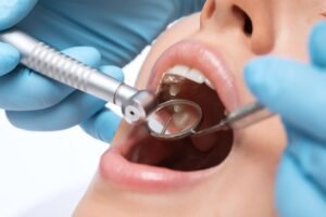 Dental tooth filling