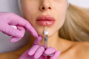 Lip Fillers Injection in Dubai