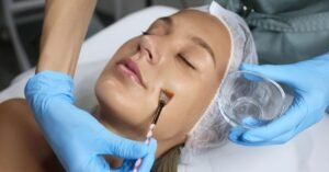 Chemical Peel Treatment in Dubai