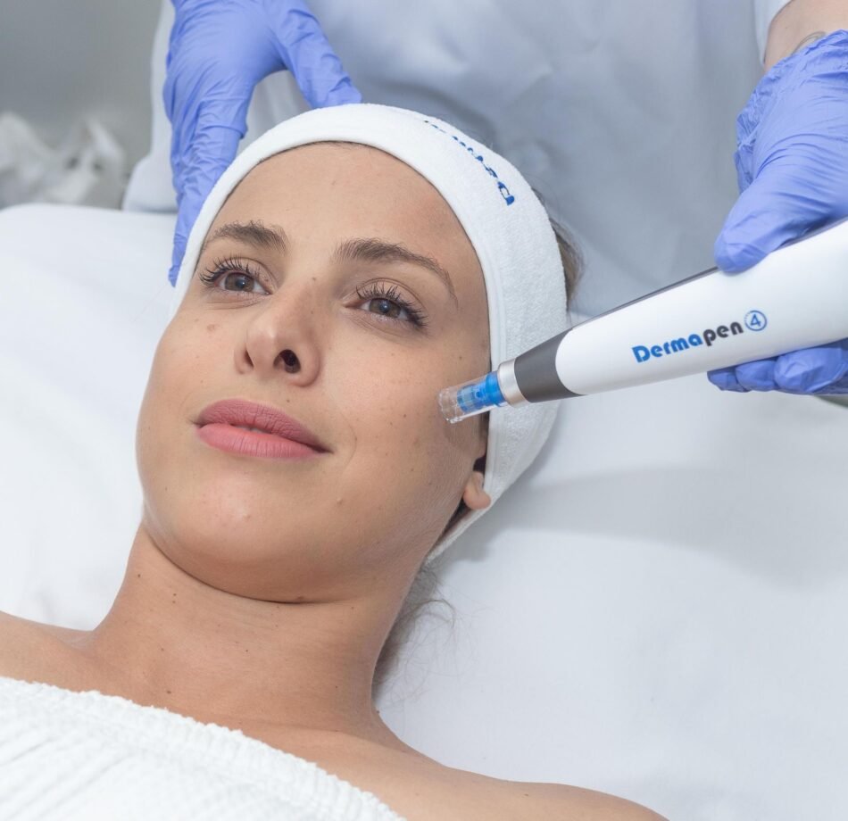 Dermapen Treatment in Dubai