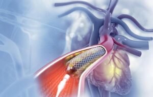 medical guidewire