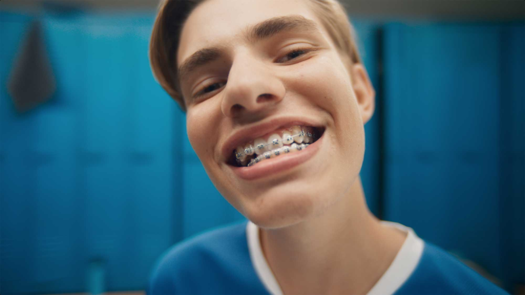 Braces treatment