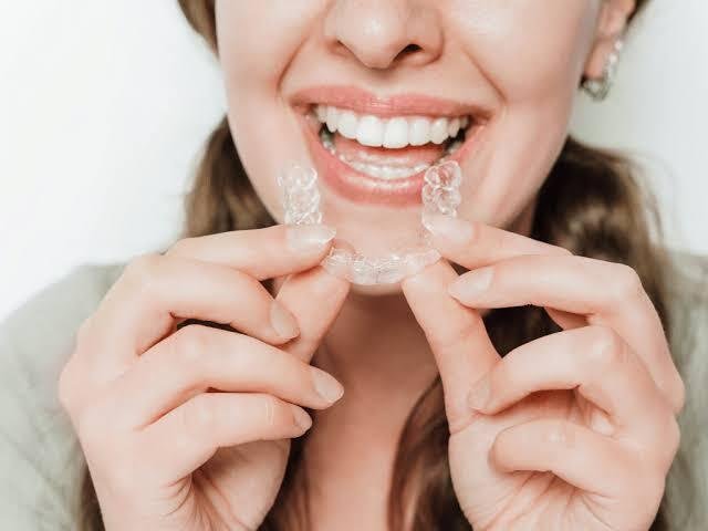 teeth aligners