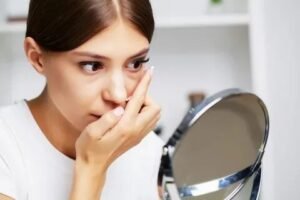 Dark Circles Treatment in Dubai
