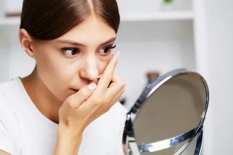 Dark Circles Treatment in Dubai