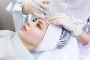 Vampire Facial in Dubai