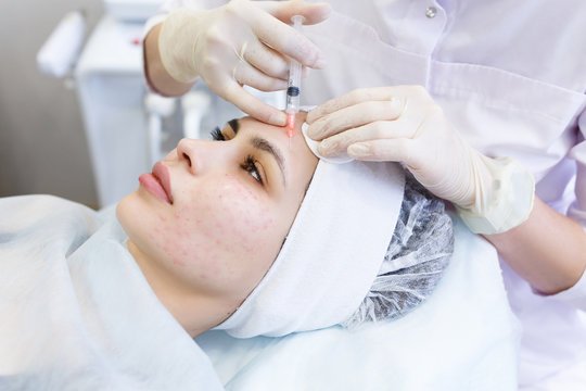 Vampire Facial in Dubai