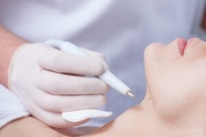 What is the best Wart Removal treatment
