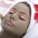 Dermamelan Treatment Dubai